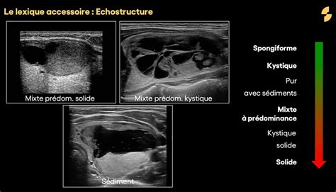 Classification EU TIRADS En Echographie Sonoschool