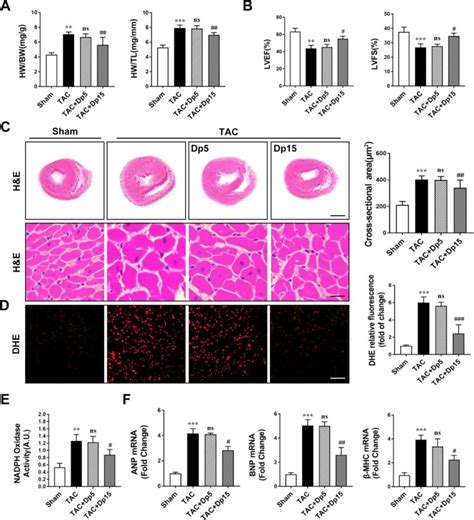 Delphinidin Attenuated Cardiac Hypertrophy And Improved Cardiac