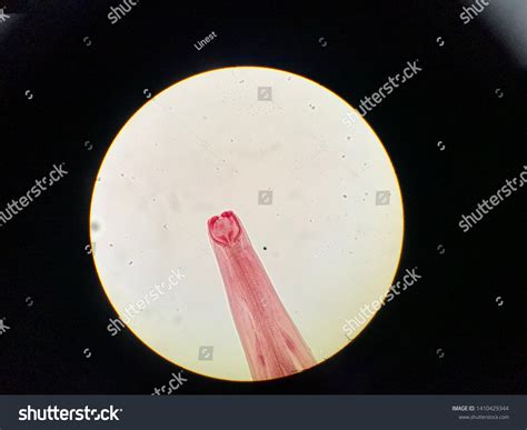 Ancylostoma Duodenale Adult Stage Light Microscope Foto De Stock