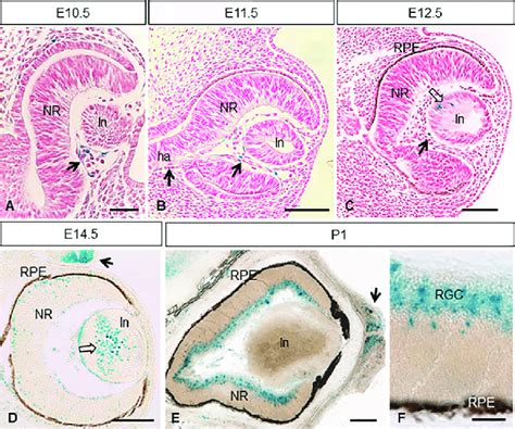 Expression Of Mt Mmp Lacz During Mouse Eye Development Gal