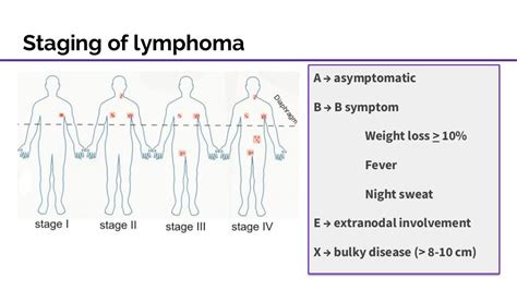 What you need to know about dlbcl