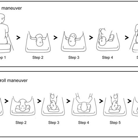 A Epley Maneuver Procedure Steps B Barbeque Bbq Roll Maneuver