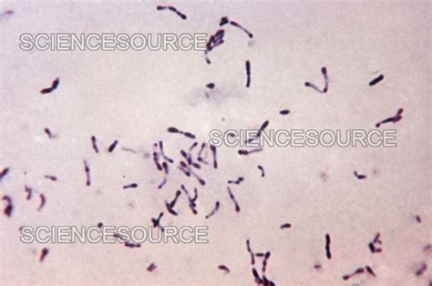 Corynebacterium Diphtheriae Simple Stain