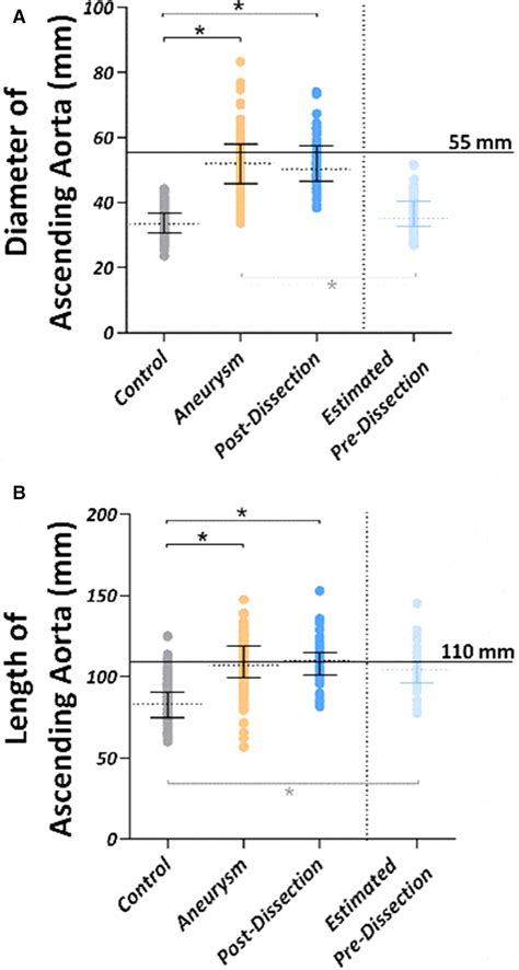 Ascending Aortic Length And Its Association With Type A Aortic