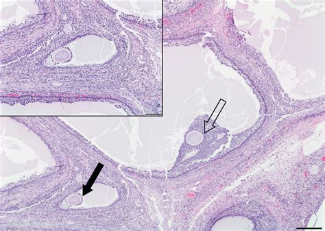 Ovarian Remnant Syndrome In A Cat With Ovarian Tissue In The Omentum In