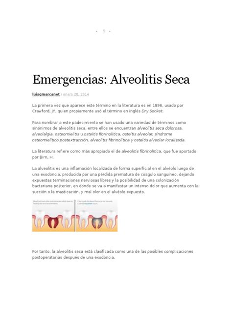 Alveolitis Seca | PDF | Medicina | Medicina CLINICA