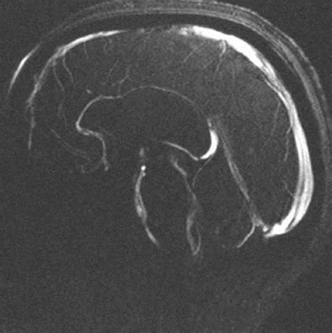 Phase Contrast Mri Physics Techniques And Clinical Applications