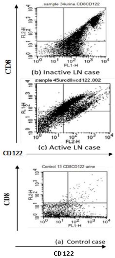 Figure From Urinary T Cells In Pediatric Lupus Nephritis Semantic