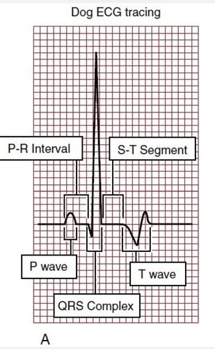 Ecg Flashcards Quizlet