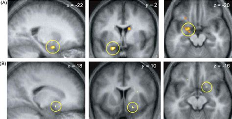 A Posterior Piriform Representations Of Odor Quality B Anterior Download Scientific