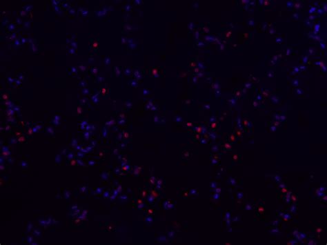 Iclick™ Tunel Andy Fluor™ 594 Imaging Assay Abp Biosciences