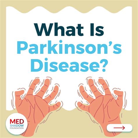 Infographics For Parkinsons Disease Medshadow Foundation