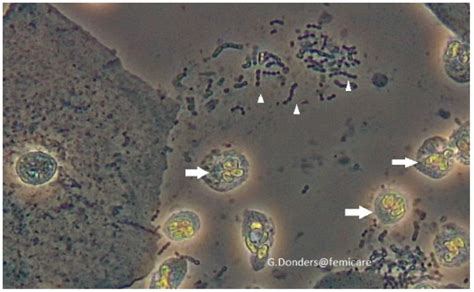 Bedside Fresh Wet Mount Microscopy Of S Viridians In Vaginal Fluid