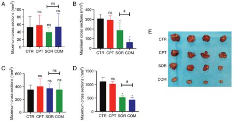 CPT Combined With Sorafenib Therapy Inhibits Tumor Growth In H22 And