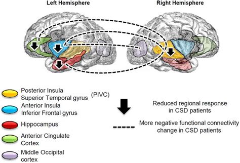 Anterior cingulate cortex, Cingulate cortex, Occipital