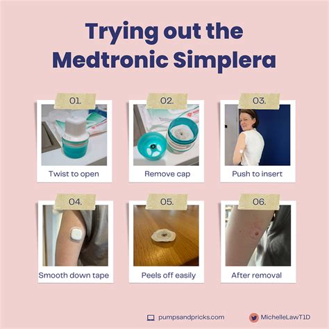 Trying Out The Medtronic Simplera Cgm