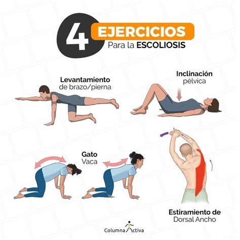 4 Ejercicios Para La Escoliosis Artofit