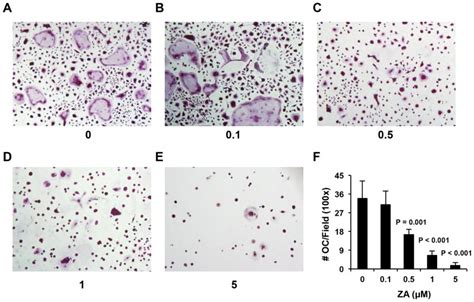 Photographic Images Of The Cell Cultures Of Gr 1 CD11b Cells Isolated