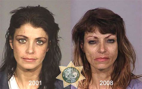 Health Info and Tips: Drug Addicts : Before and After