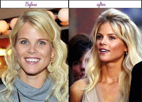 Elin Nordegren Before And After