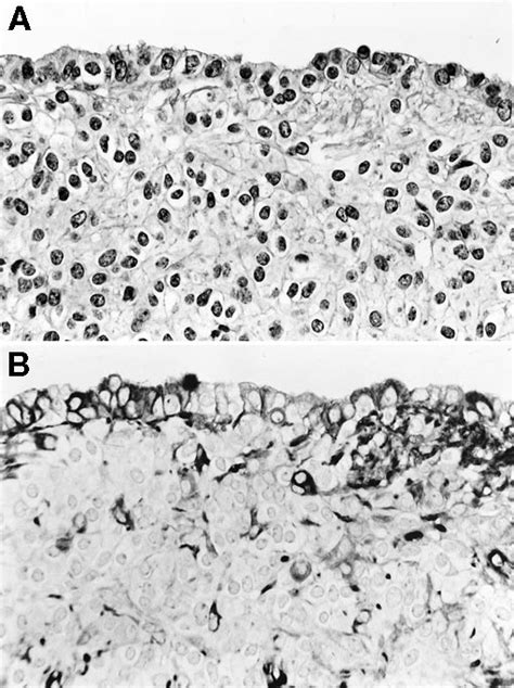 A Photomicrograph Showing Epithelial Features In A Limited Area Download Scientific Diagram