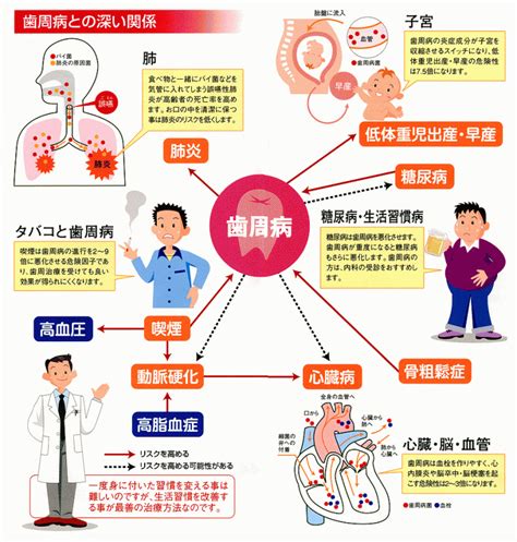 歯周病って怖い病気なんです！ ひがみ歯科立川クリニック ブログ