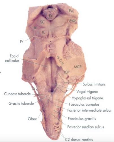 Brainstem Cross Sections Flashcards Quizlet