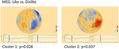 Frontiers Neuronal Correlates Of Product Feature Attractiveness