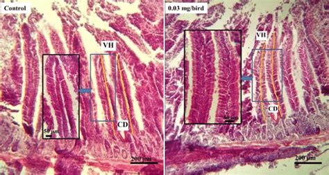 Histological Representation Of Duodenal Mucosa Of Control And