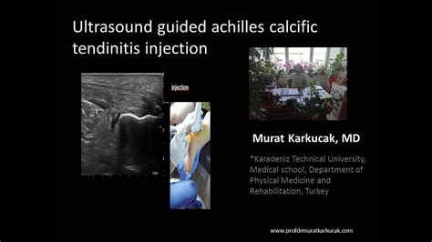 Ultrasound Guided Achilles Calcific Tendinitis Injection Youtube