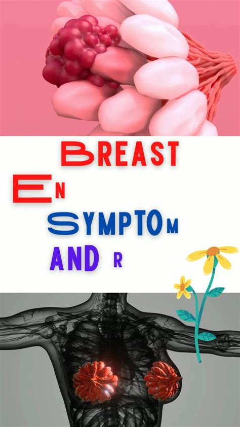 What Are Breast Engorgement Symptoms And Relief Tips Artofit