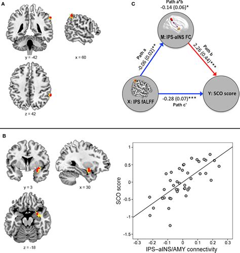 Frontiers Intrinsic Functional And Structural Brain Connectivity In