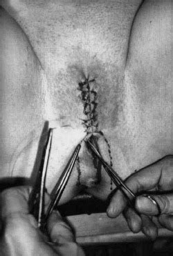PussymodsgaloreBDSM Pain Games Sewing Her Porn Photo Pics