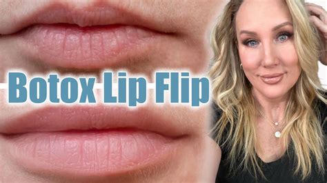 Botox Lip Flip Full Tutorial