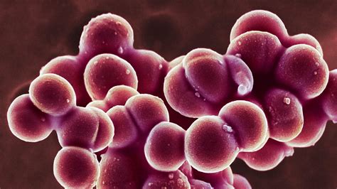 New Guidance To Stem The Tide Of Mrsa Spread In Hospitals Medpage Today