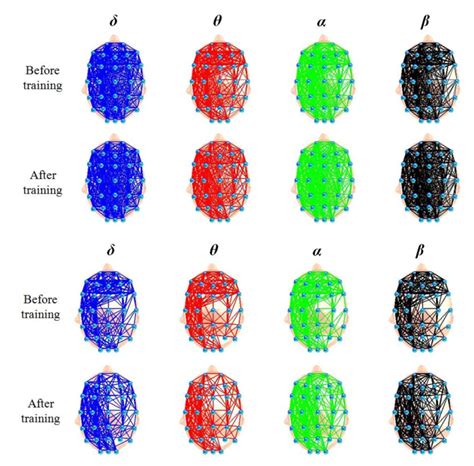 Functional Brain Networks In Different Frequency Bands When The