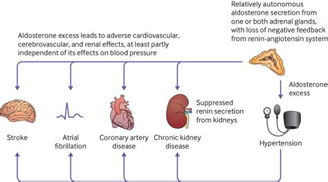 Primary Aldosteronism The Bmj