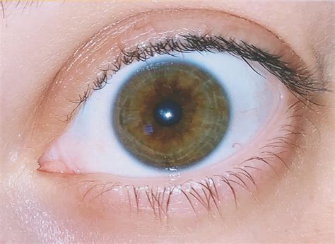 Central Heterochromia Brown Eyes