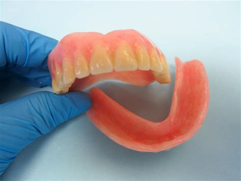 The Most Common Questions About Dentures