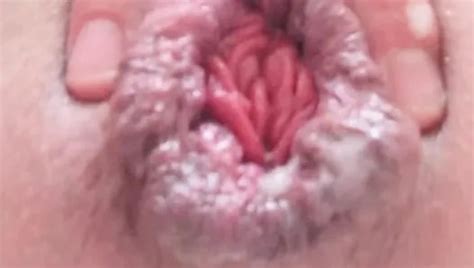 Free Loose Hole Gay Porn Videos XHamster