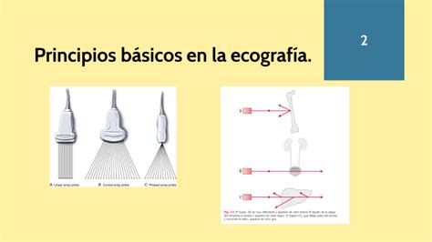 Principios Basicos Ultrasonido By On Prezi