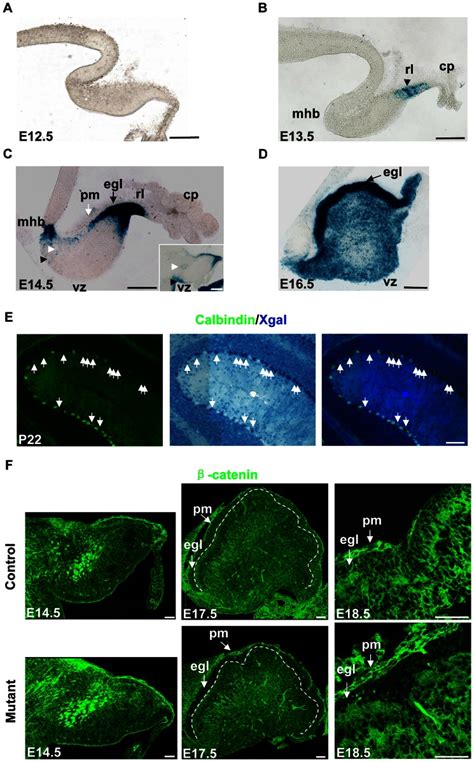 Sagittal Sections Were Shown A Xgal Staining In An E12 5 Hgfap Cre