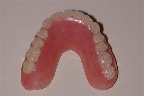 Proth Se Implanto Port E Prosthodontie Rive Sud Inc