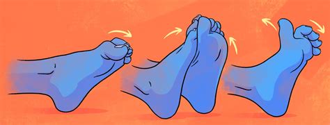 Psoriatic Arthritis In The Feet: Tips to Manage Plantar Fasciitis