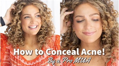 How To Cover Breakouts And Acne Featuring A Professional Makeup Artist