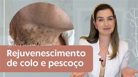 Rejuvenescimento De Colo E Pesco O Dra Mariana Piccinin Youtube