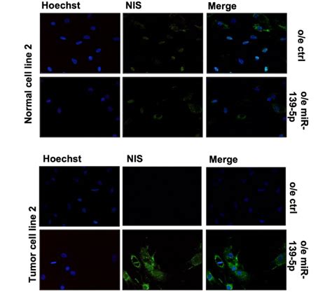 Nis Subcellular Localization In Primary Cell Lines Nis Stained Green