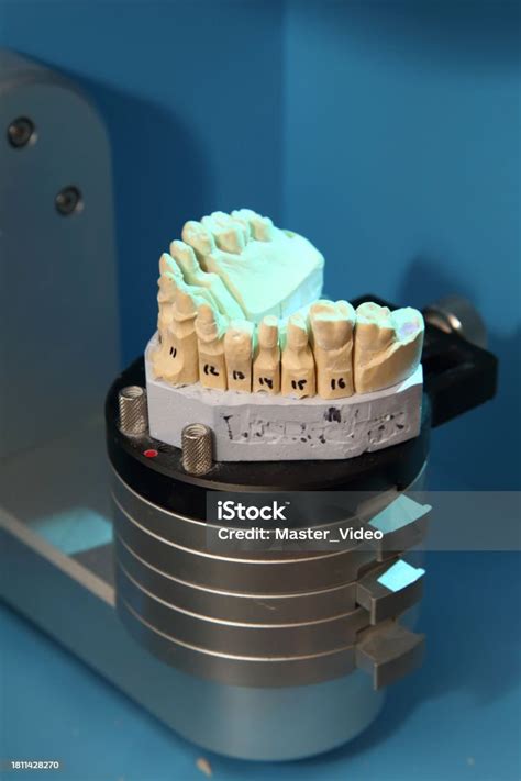 Fabrication Of Dental Crowns And Dentures Made Of Ceramic Scanning Of