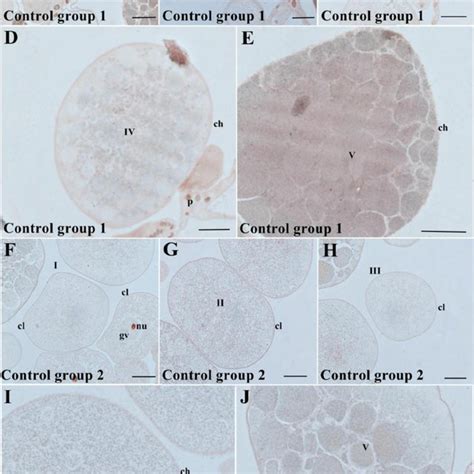 Histological Sections Of The Rhipicephalus Sanguineus Oocytes Stained