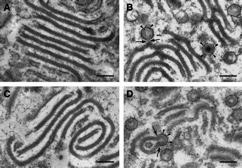 Immunoelectron Microscopy Of Protein Pe R On Va Infected Cells